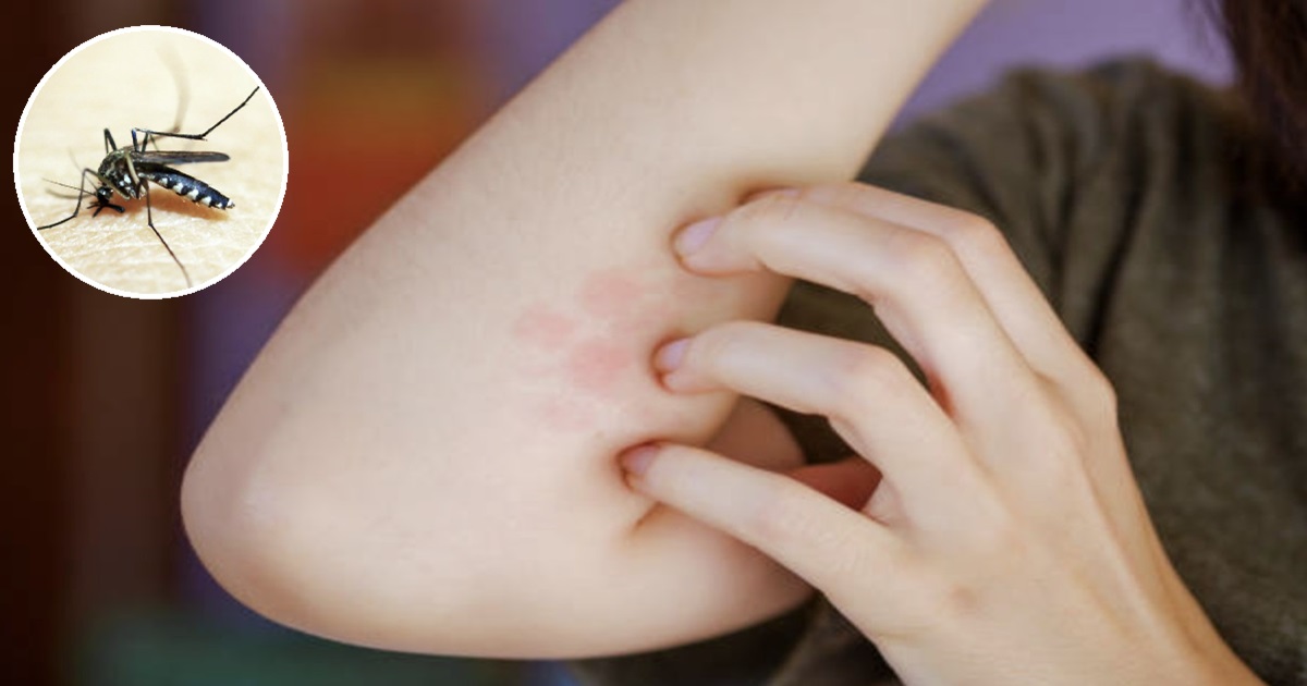 Eliminate Mosquito Bites in Just 2 Minutes with Zero Effort